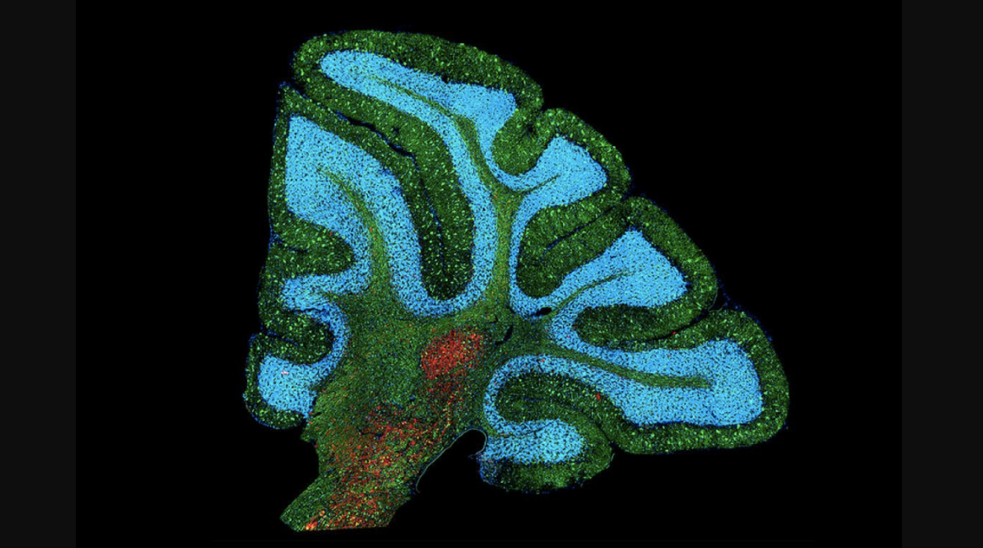 Niemann-Pick disease type C1, a lipid storage disorder, as seen in a mouse cerebellum / Credit: NICHD