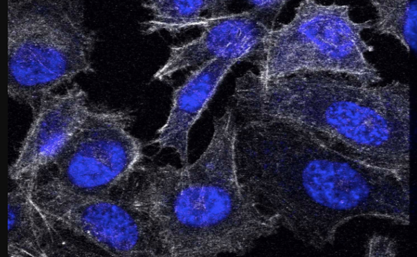 Prostate cancer cells, such as the ones in this image, might be targeted by these new molecular motors. / Credit: Wikimedia Commons/Griersonj5