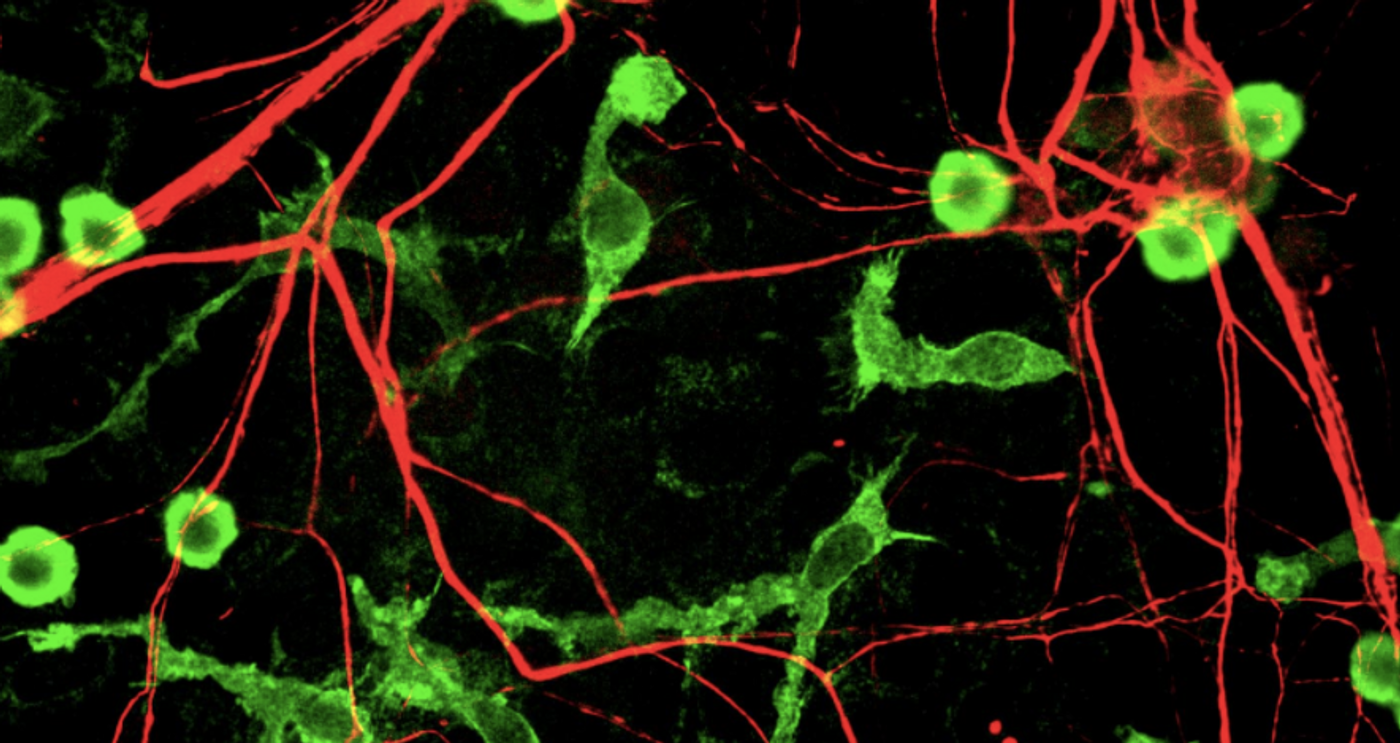 Mixed rat brain cultures stained for coronin 1a, found in microglia here in green, and alpha-internexin, in red, found in neuronal processes. Credit: Wikimedia Commons/ EnCor Biotechnology Inc./GerryShaw