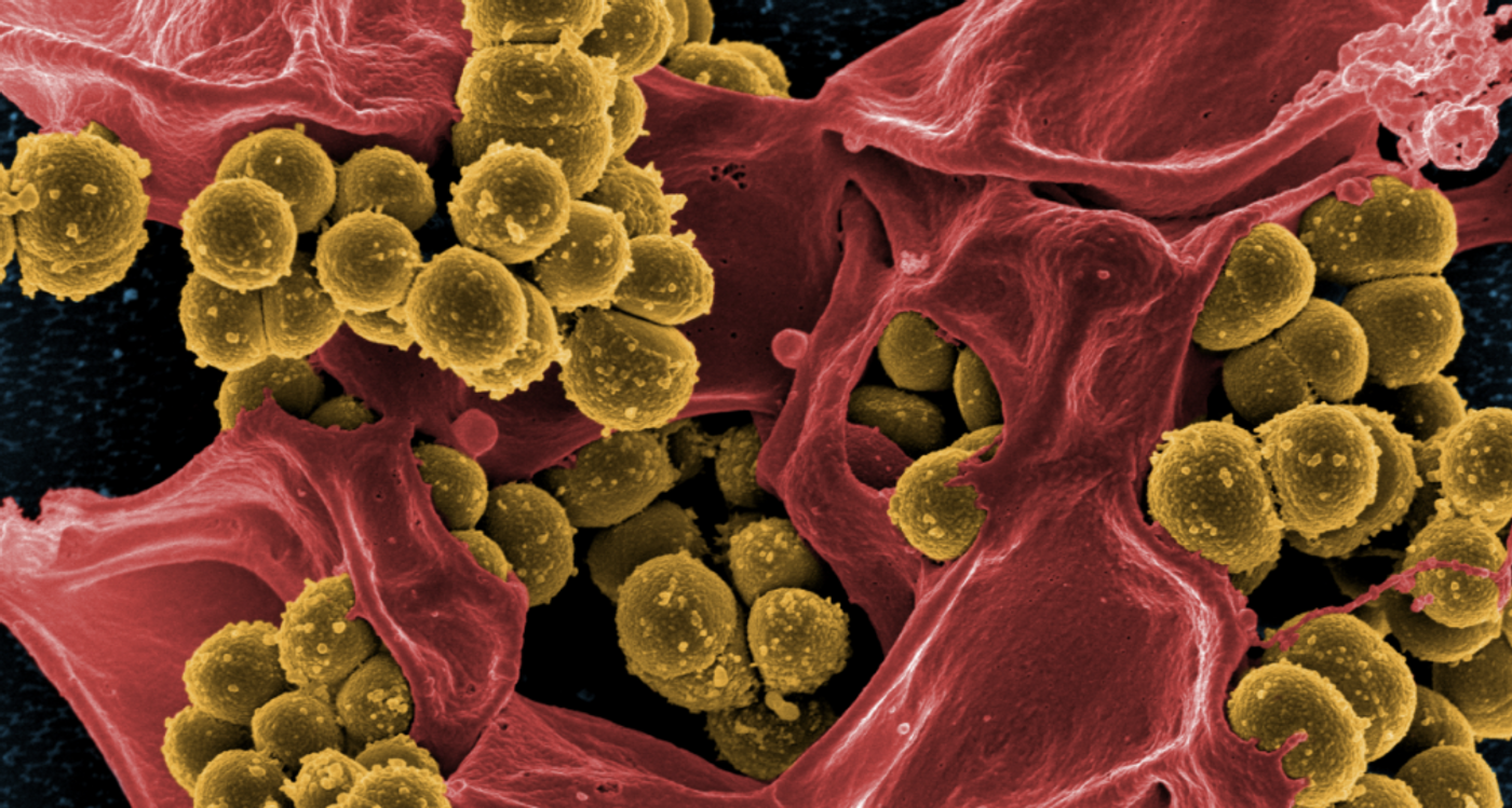 Scanning electron micrograph of methicillin-resistant Staphylococcus aureus and a dead human neutrophil. / Credit: NIAID