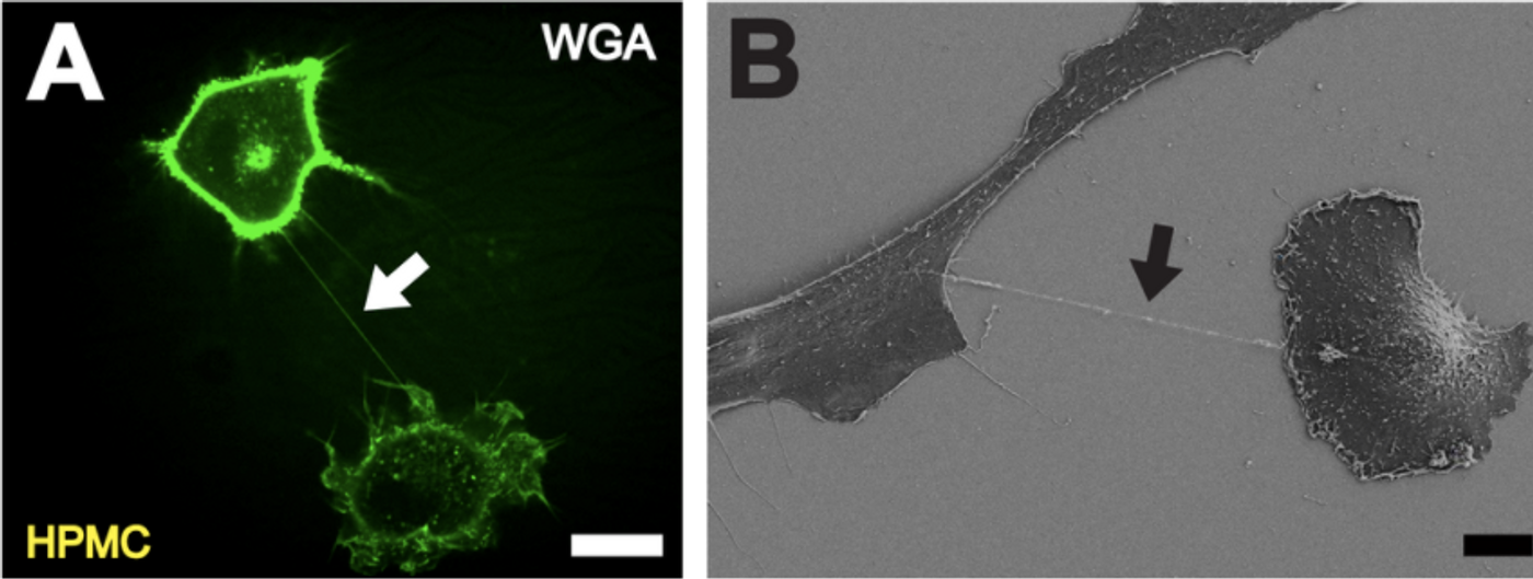 A. High resolution 3D live-cell fluorescence image of a nanotube (white arrow) connecting two primary mesothelial cells one hour after plating on a collagen I coated glass cover slide. To facilitate detection, cell membranes were stained. Scale bar: 20 µm. B Depiction of a NT (black arrow) between two cells with scanning electron microscopy one hour after cell plating. Scale bar: 10 µm. / Credit: Ranzinger J, Rustom A, Abel M, Leyh J, Kihm L, et al. - PLoS One