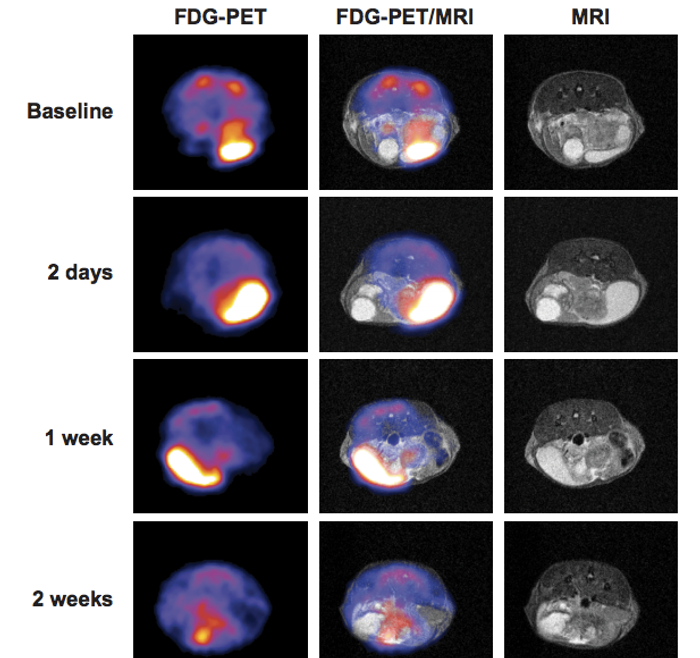 Representative FDG-PET/MRI co-registration images showing the impact of cabozantinib on regression of prostate tumors in Pb-Cre; PTENfl/fl/p53fl/fl mice. / Credit: Cancer Discovery Patnaik et al 2017