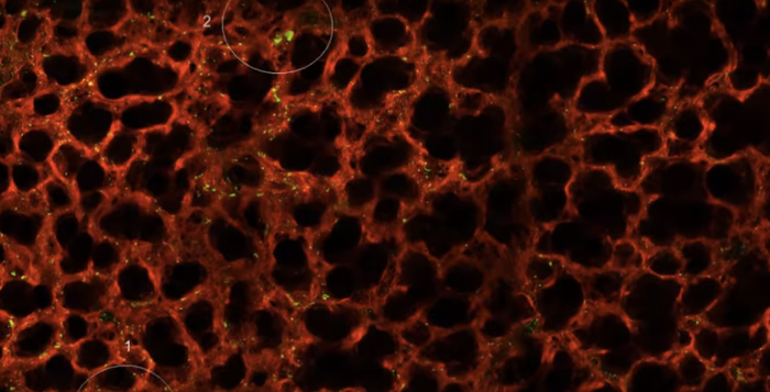 A look inside the mouse lung, at (green) megakaryocytes / Credit: UCSF