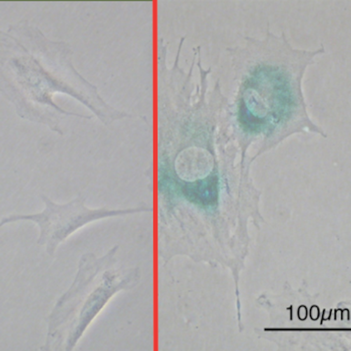 (Left) Before senescence (MEFs were spindle shaped). (Right) After senescence (MEFs grew larger and flatten). Blue-green areas indicate the expression of senescence-associated beta-galactosidase. Modified from Wikimedia Commons/Y tambe