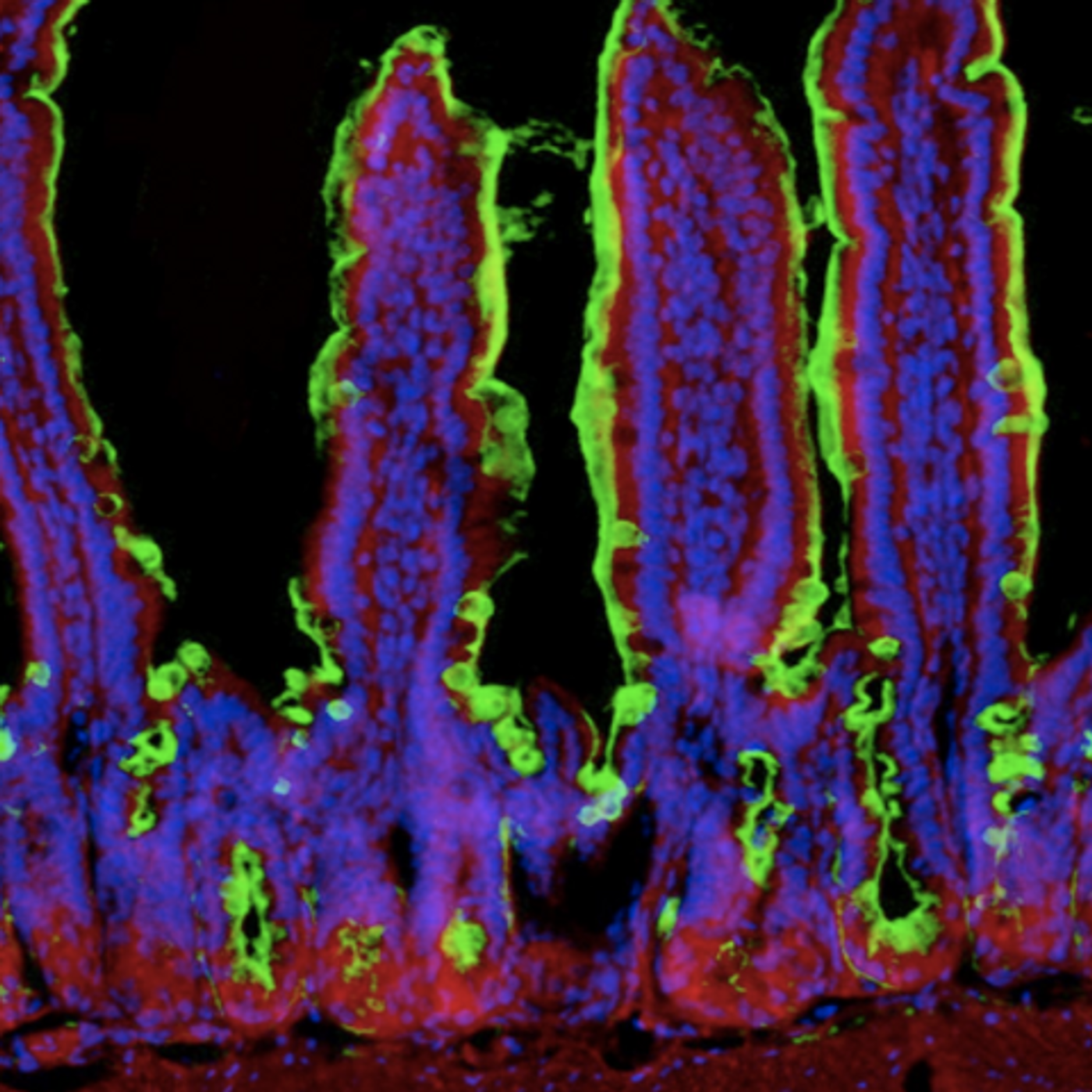 Recurrent food poisoning induces a pro-inflammatory enzyme (green) that disrupts the body's ability to detoxify resident normal gut bacteria. / Credit: Jamey Marth