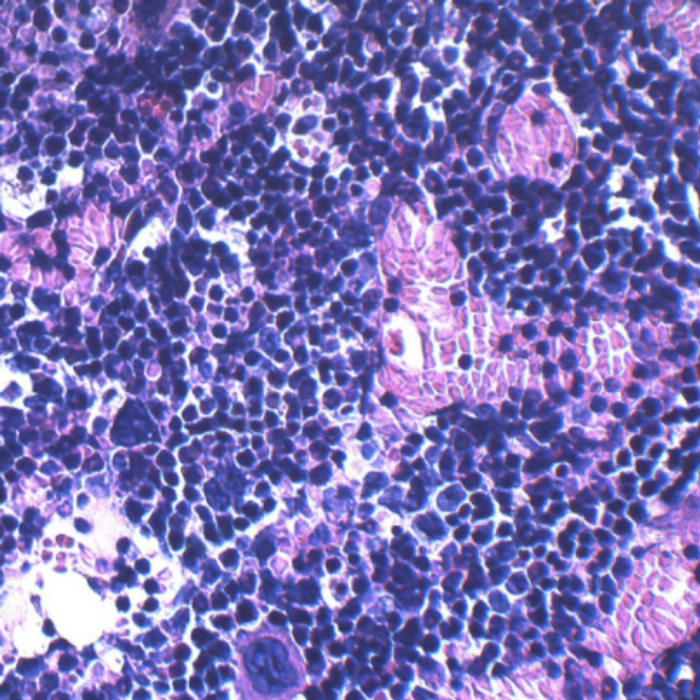 This microscopic image shows bone marrow cellularity and composition in a non-obese control mouse/ Credit: Cincinnati Children's