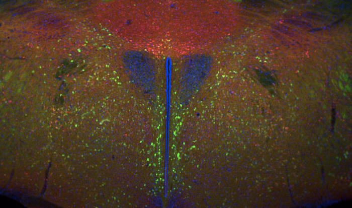 A stained hypothalamus (nuclei in blue) / Credit: NIH/Margaret I. Davis