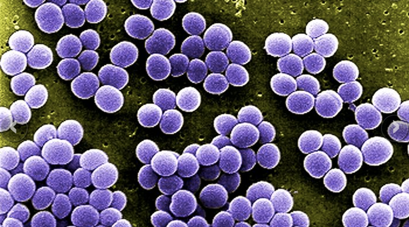 S. aureus / Image credit: Pixnio