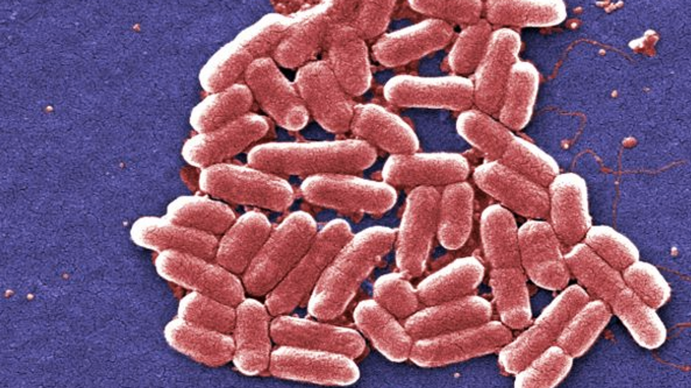 E. coli bacteria, one of the many strains commonly found in the human intestines. / Image credit: Pixnio