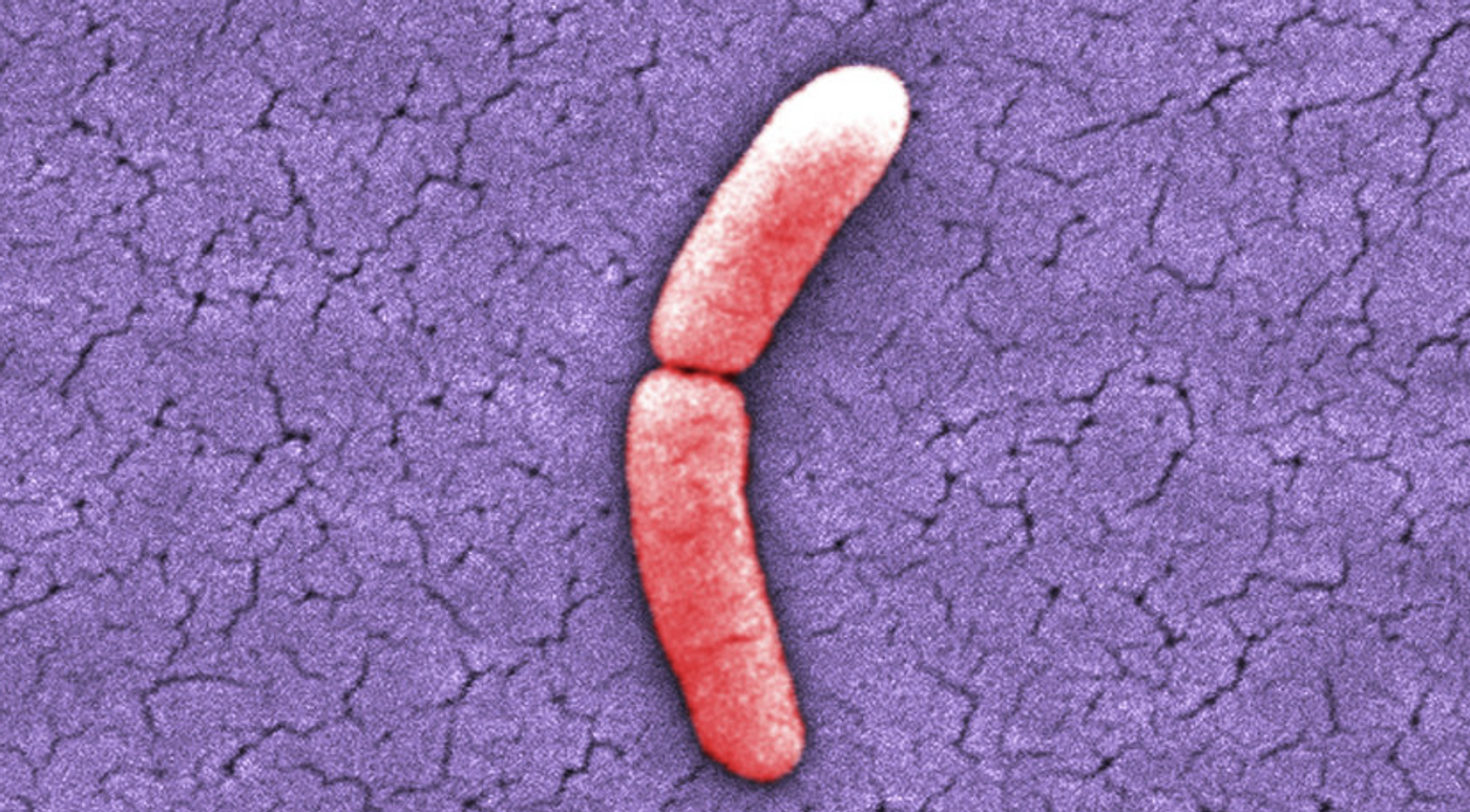 15000X, colorized scanning electron micrograph (SEM) of Salmonella typhimurium bacterium / Credit:CDC/ Bette Jensen