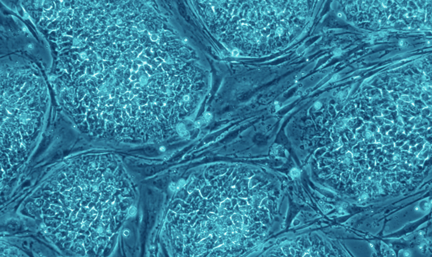 Human embryonic stem cells/ Credit: Nissim Benvenisty