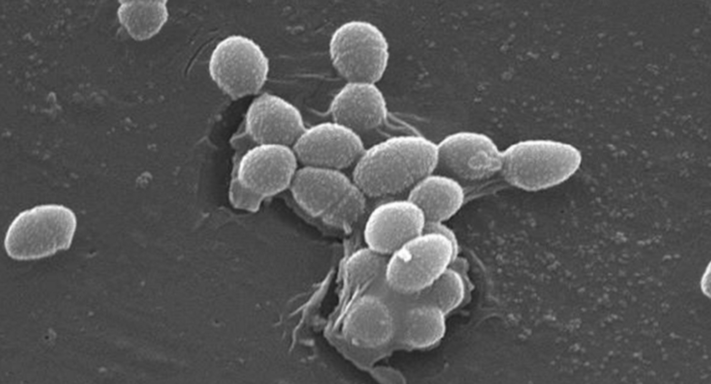 Scanning Electron Micrograph of Enterococcus faecalis / Credit: Janice Haney Carr/CDC