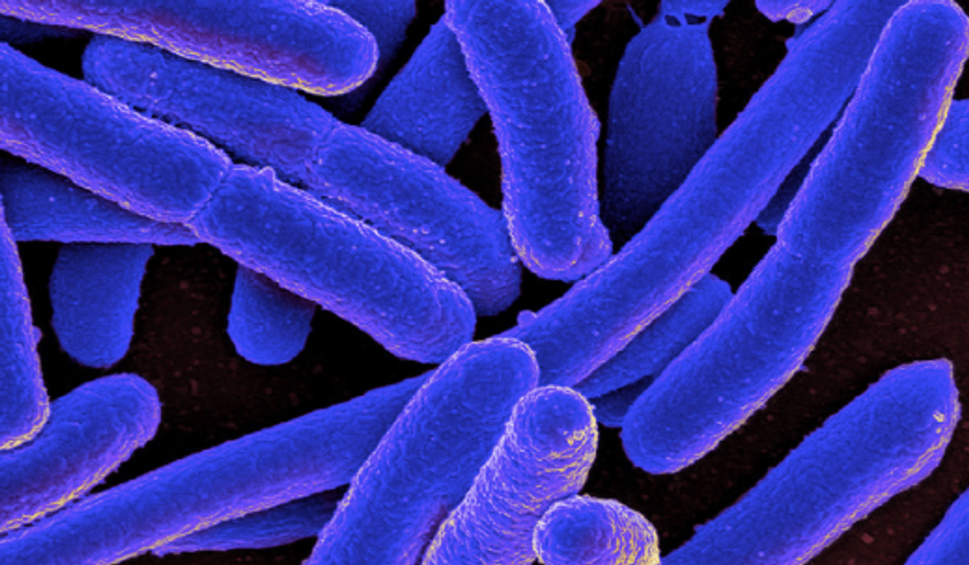 Colorized scanning electron micrograph of Escherichia coli, grown in culture and adhered to a cover slip./  Credit: NIAID