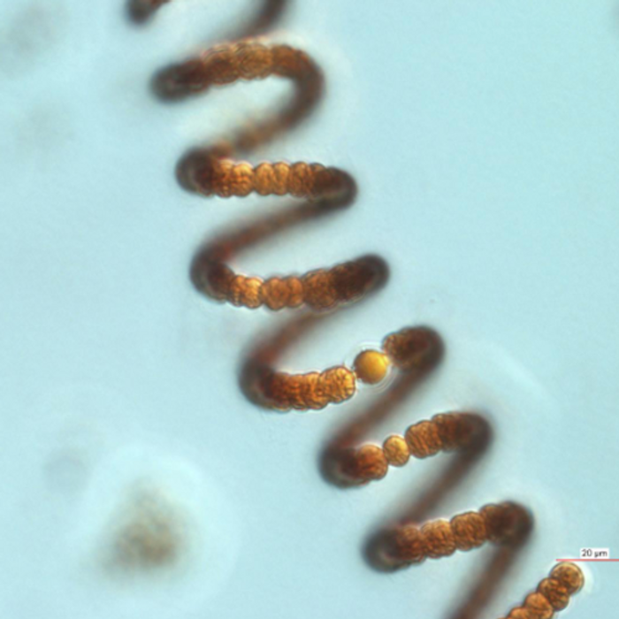 Microscope image of the nitrogen-fixing blue-green alga Anabaena crassa from the lake Müggelsee.  / Credit: Image: IGB