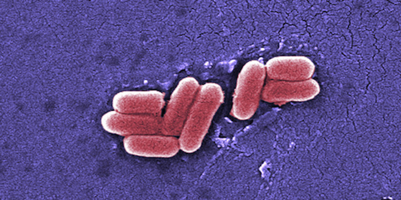 Scanning electron micrograph of E. coli / Image credit: Public Domain Files