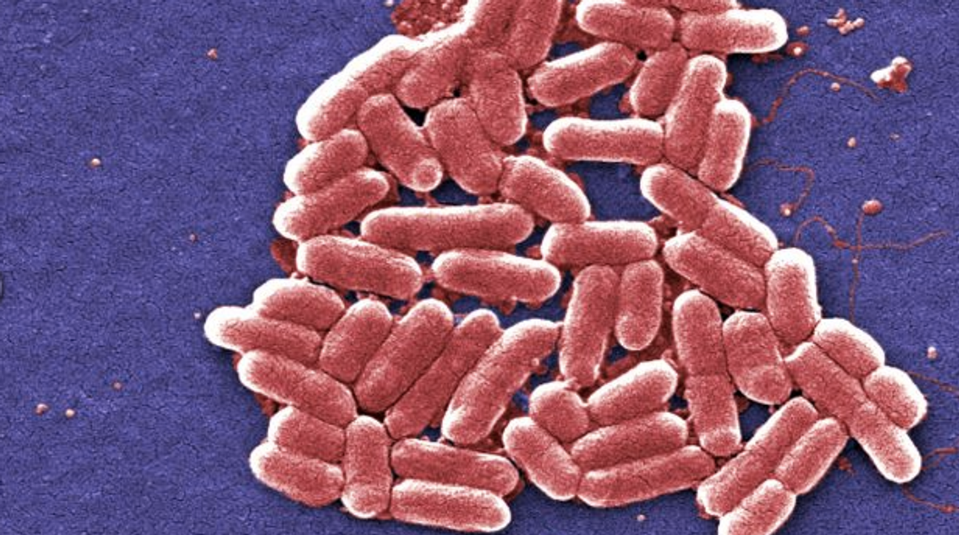 Many bacterial strains can make up the microbiome, like E coli, seen here / Image credit: Adapted from pixnio