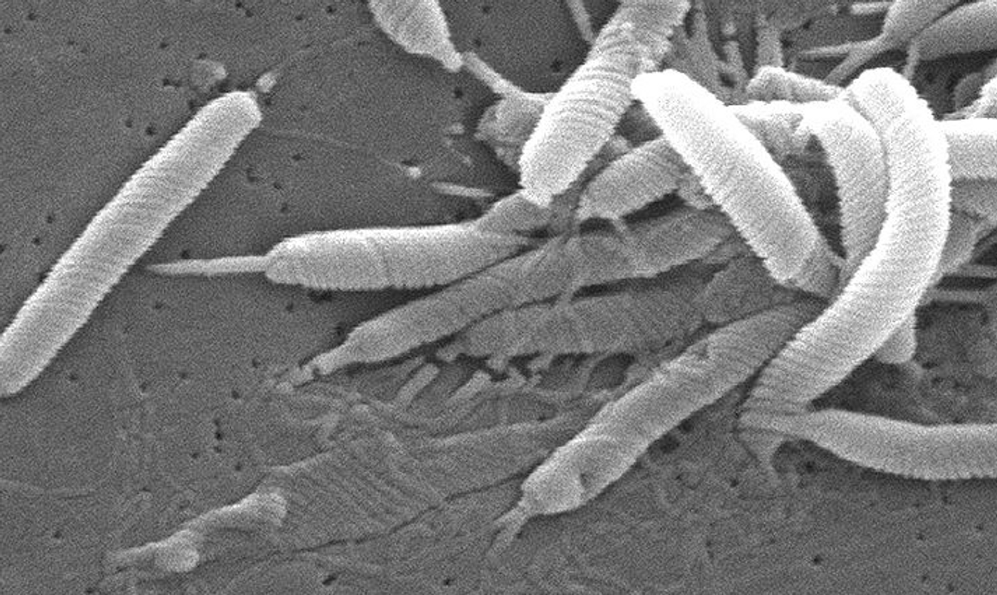 Scanning electron micrograph of Helicobacter bacteria / Credit: CDC/Dr. Patricia Fields, Dr. Collette Fitzgerald