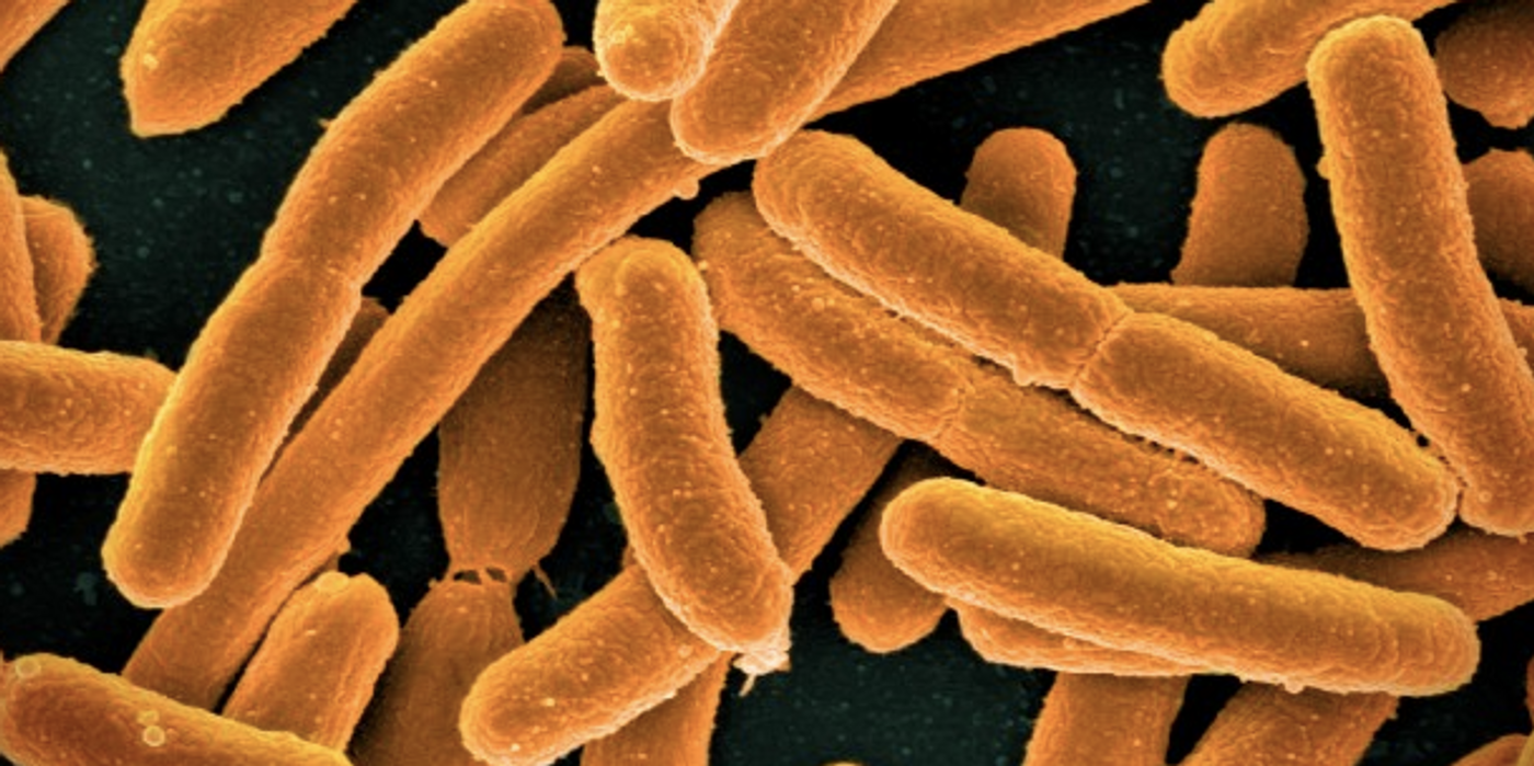 Colorized scanning electron micrograph of Escherichia coli / Image credit: NIAID