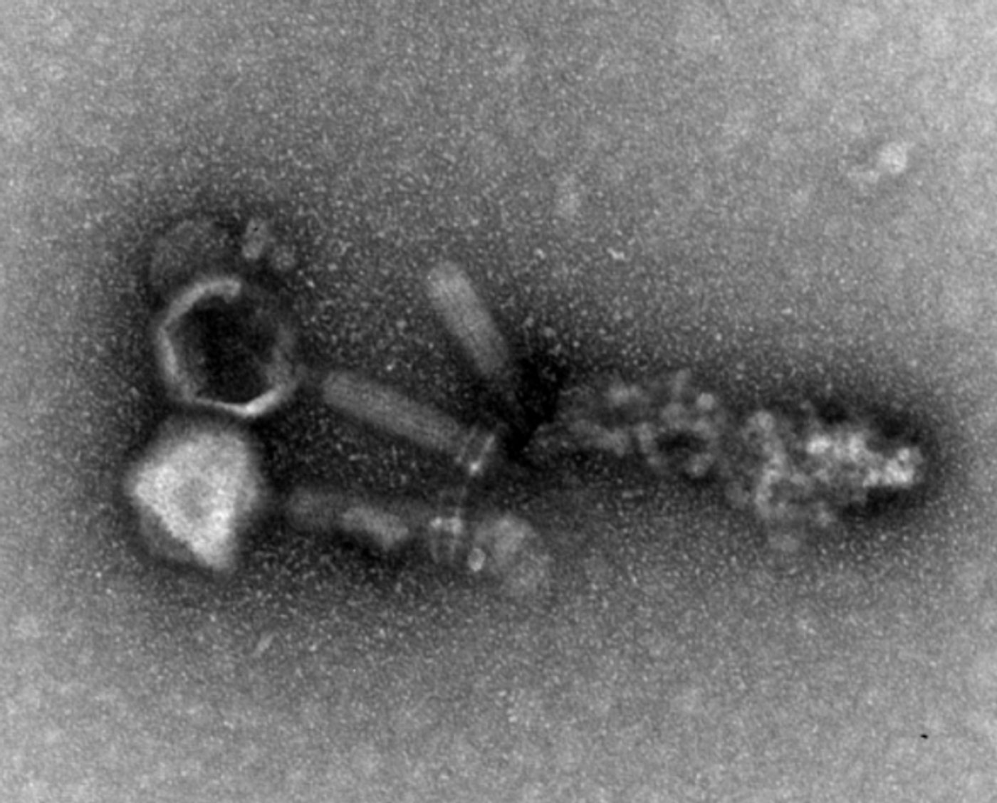 This is bacteriophage EFDG1 visualized by transmission electron microscopy at a magnification of 20,000 -- 30,000 times. Note that some phages are still bound to remains of the dead bacteria. / Credit: Photo: Ronen Hazan / Hebrew University