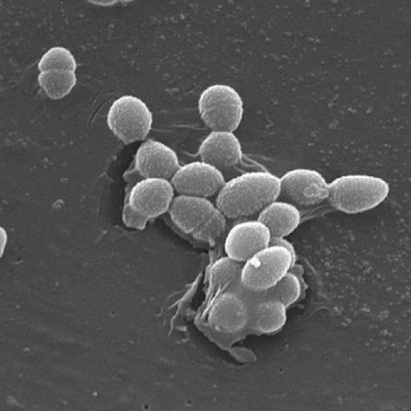 Scanning Electron Micrograph of Enterococcus faecalis / Credit: CDC