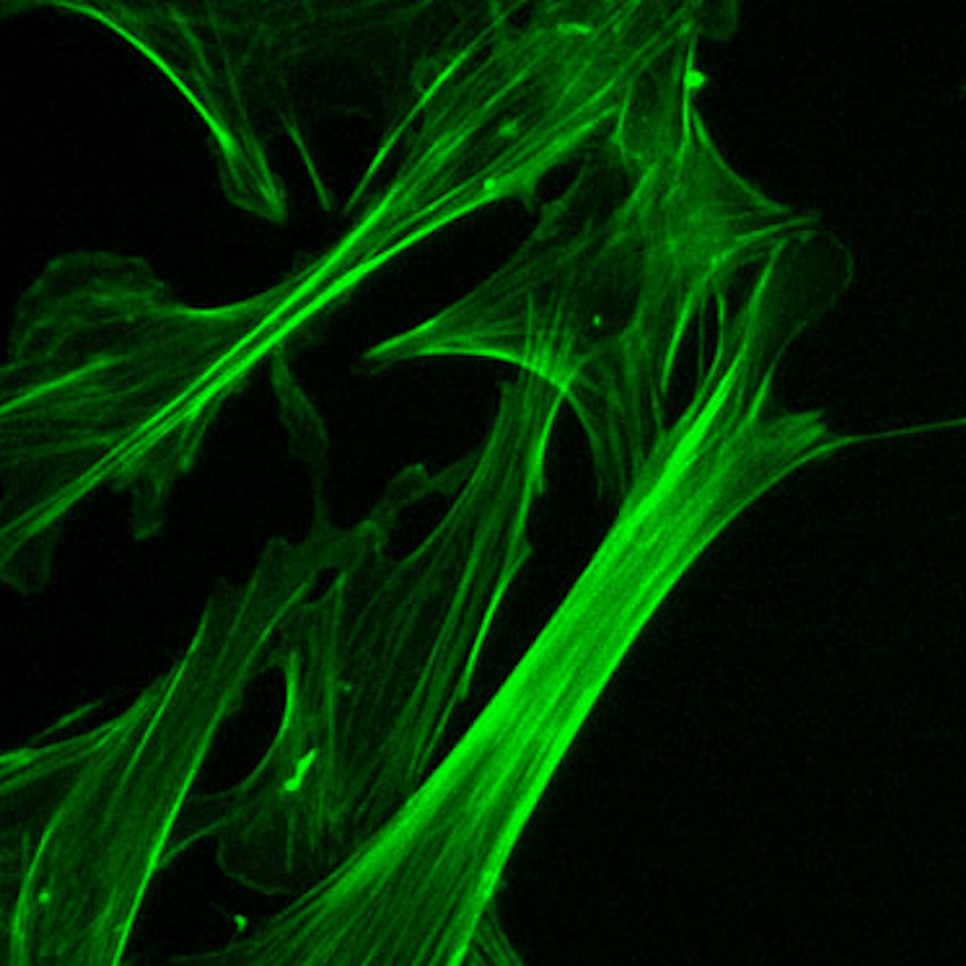 Microfilament (actin cytoskeleton) of mouse embryo fibroblasts, stained with FITC-phalloidin (100-fold magnification.)/ Credit: Wikimedia Commons/Y tambe