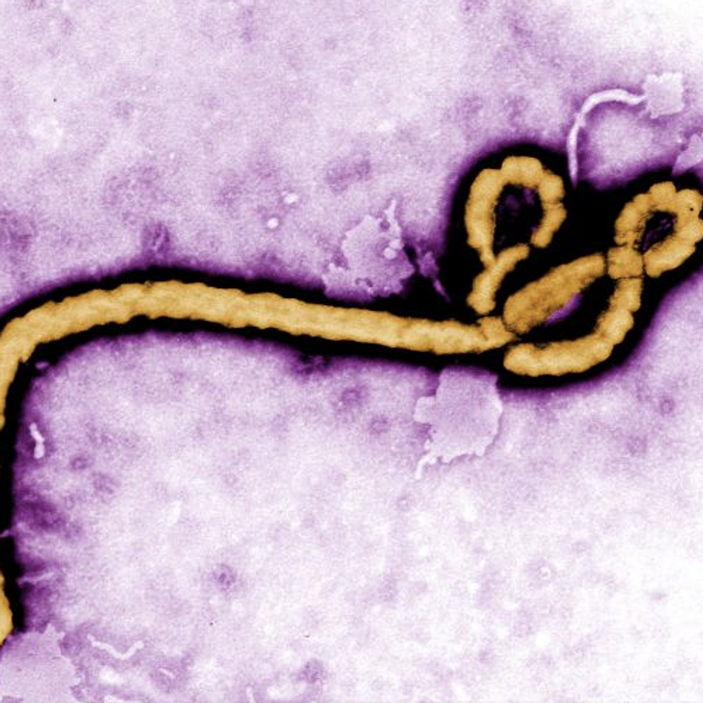 The Ebola virus / Credit: Pixnio