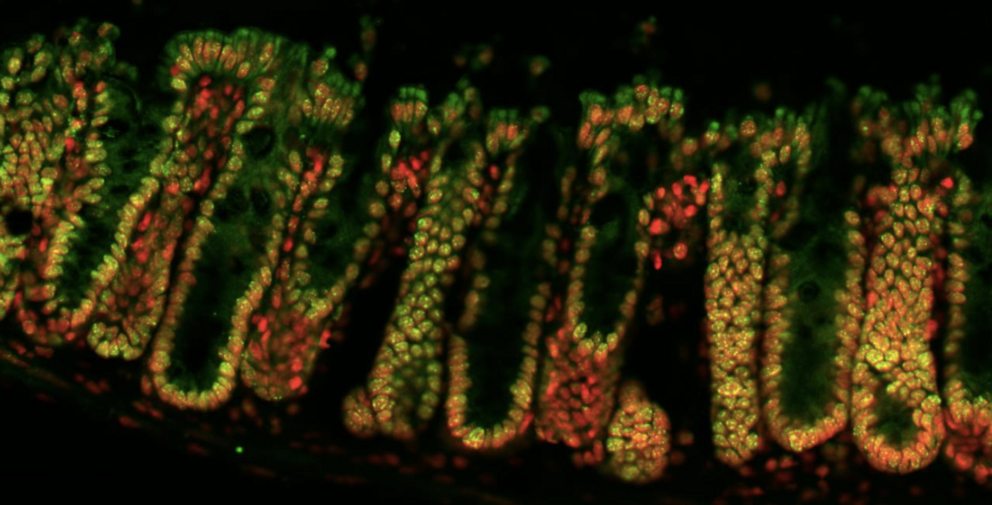 The lining of a mouse large intestine, DNA is in red while crotonylation is highlighted in green. Yellow indicates DNA and crotonylation together. / Image credit: Dr Juri Kazakevych, Babraham Institute 