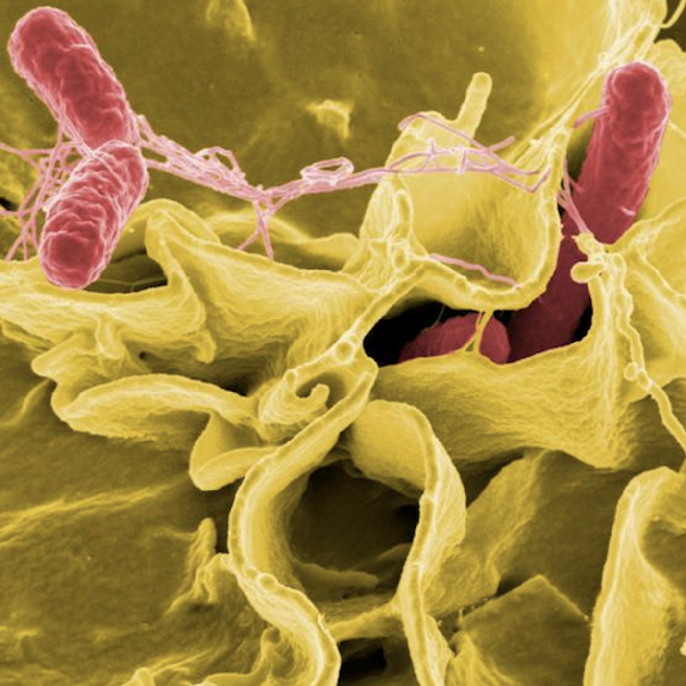 Salmonella bacteria, a common cause of foodborne disease, invade an immune cell. / Credit: NIAID