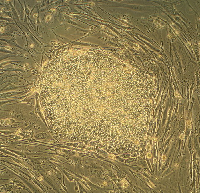 A colony of embryonic stem cells / Credit:Wikimedia Commons/ Ryddragyn