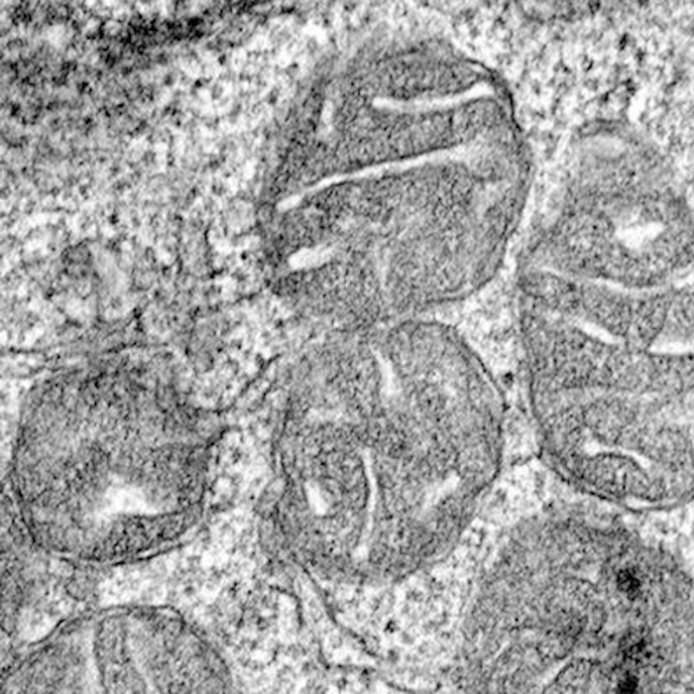 An electron microscope image showing the mitochondria (like the cell's batteries) inside an erythroid progenitor, the cell that divides to make red blood cells. This image was taken at 50,000x magnification -- 70 of these images lined up side-by-side would equal the diameter of a human hair. / Credit: Courtesy Goldfarb lab, University of Virginia School of Medicine