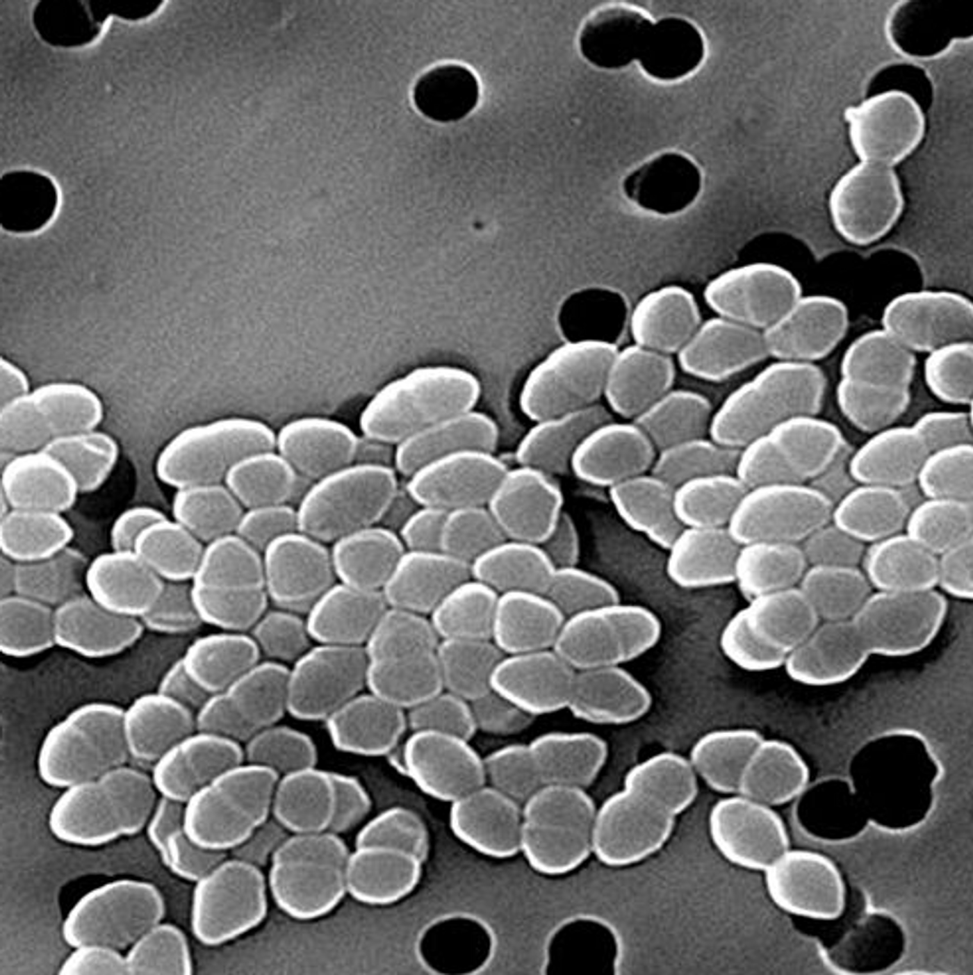 Scanning Electron Micrograph of Vancomycin Resistant Enterococci / Credit: Centers for Disease Control and Prevention's Public Health Image Library