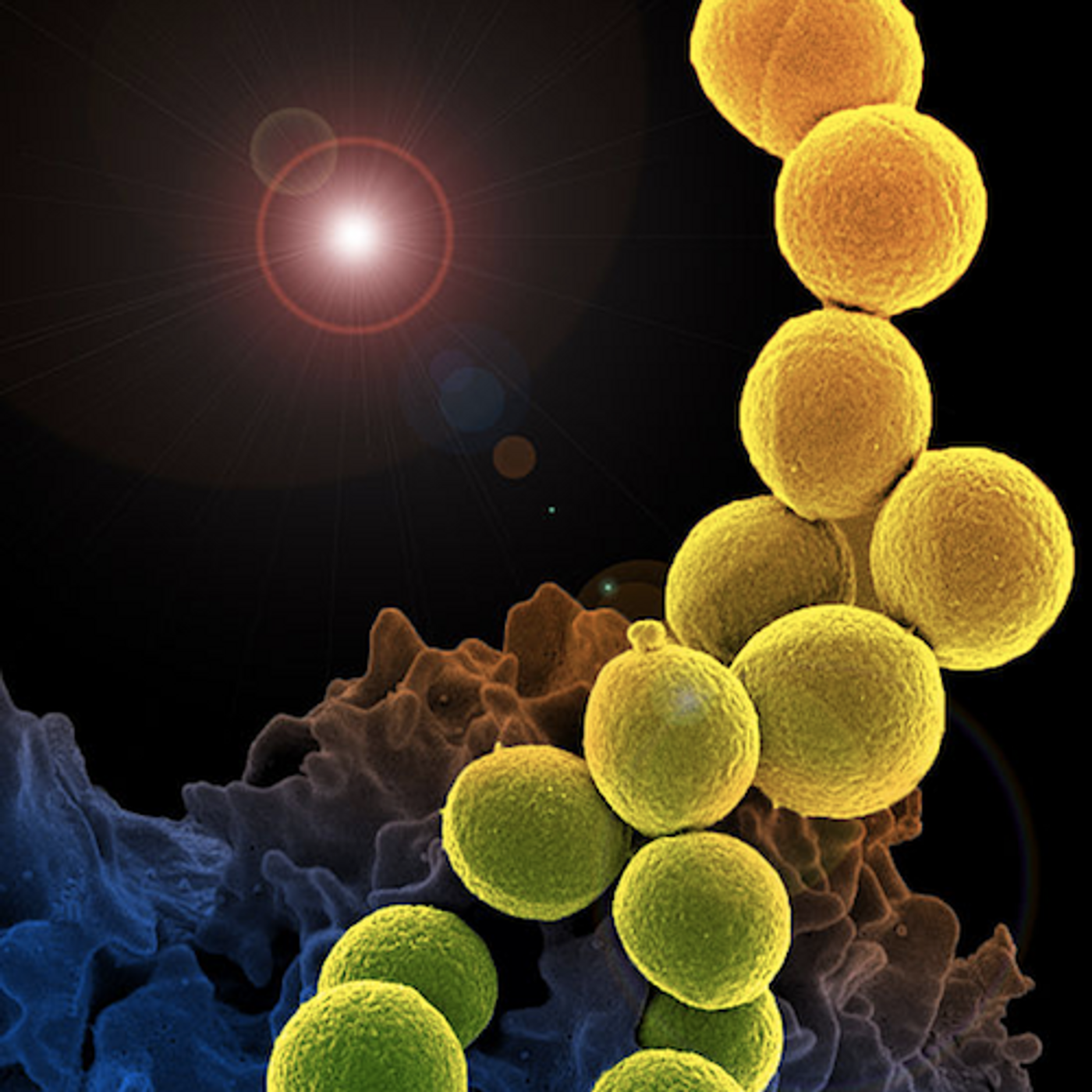  This is a colorized scanning electron micrograph of a white blood cell eating an antibiotic resistant strain of Staphylococcus aureus bacteria, MRSA. / Credit:NIH