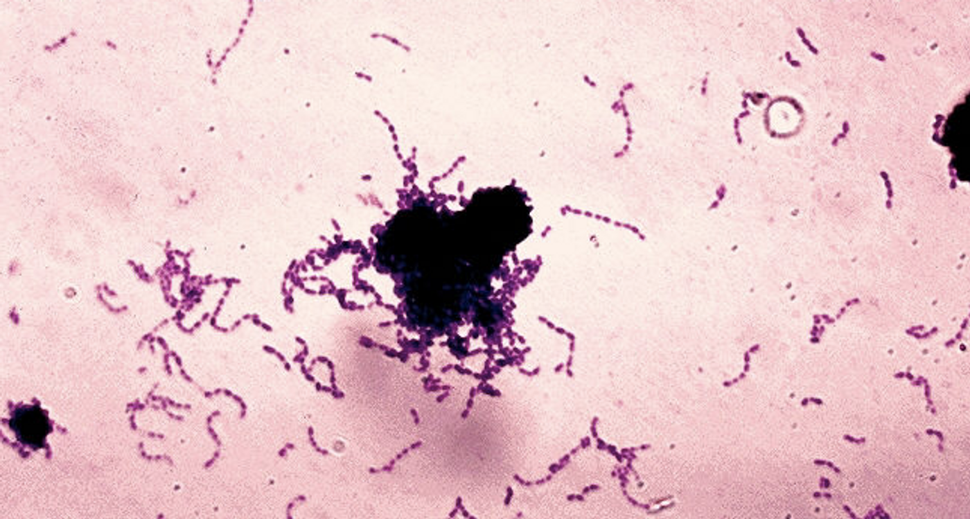 Recurrent Streptococcal infections might be caused when lysozyme meets penicillin. / Image credit: CDC/Wikimedia Commons