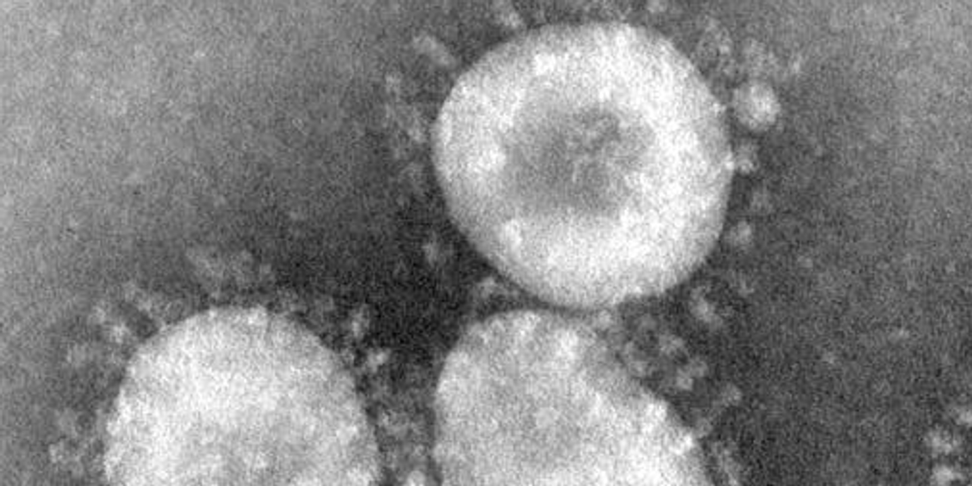 Coronavirus, which is now recognized as the etiologic agent of the 2003 SARS outbreak / Credit: CDC
