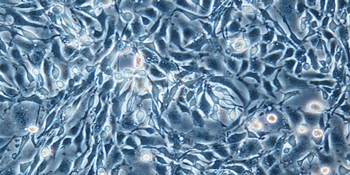 CHO cells are often used in bioproduction. / Image credit: Wikimedia Commons/Alcibiades
