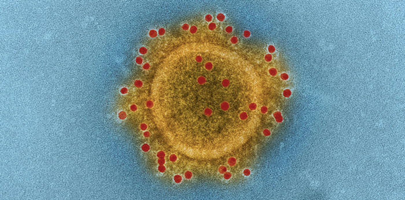 Middle East Respiratory Syndrome Coronavirus particle envelope proteins immunolabeled with Rabbit HCoV-EMC/2012 primary antibody and Goat anti-Rabbit 10 nm gold particles. / Credit: NIAID