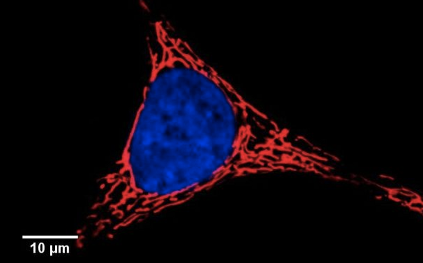 Confocal image of living HeLa cells. Mitochondria are stained in red / Wikimedia Commons/8x57is