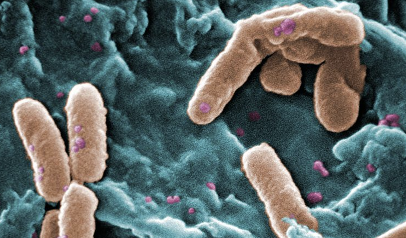 Pseudomonas aeruginosa bacteria / Credit: Centers for Disease Control