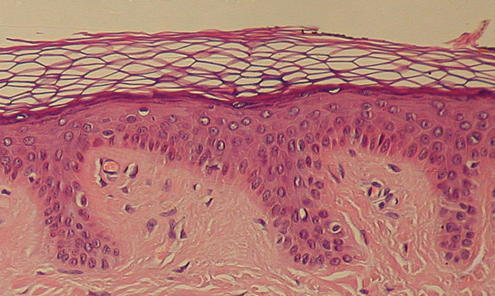 The interstitium was found in connective tissue, including the dermis (the middle, dark layer) / Image credit: Wikimedia Commons