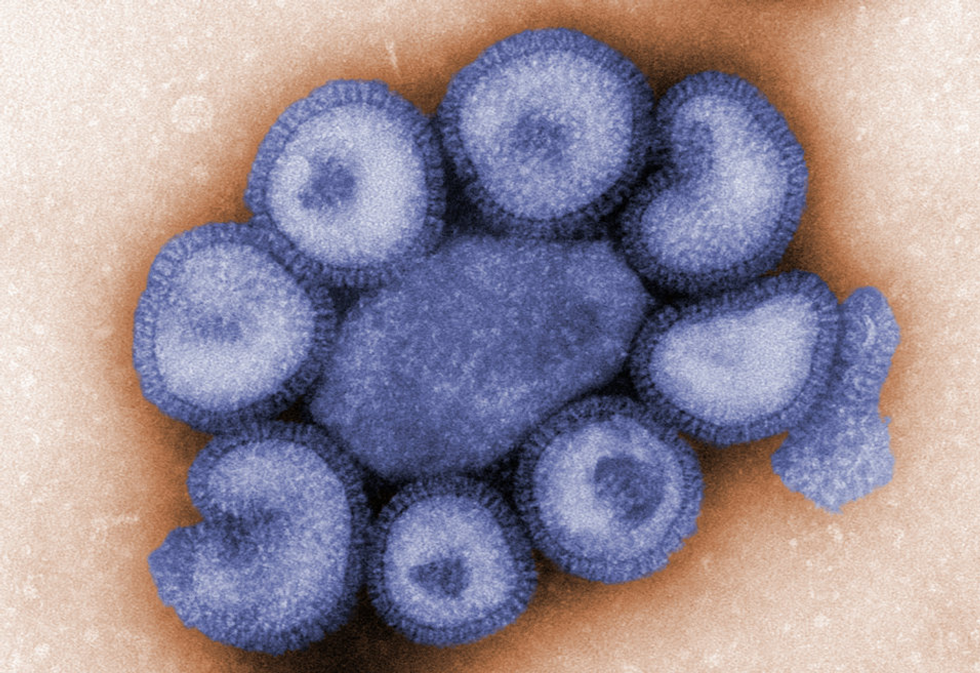 Colorized, negative-stained TEM depicting a number of influenza virus particles. The influenza virus is a single-stranded RNA organism, and a member of the taxonomic family Orthomyxoviridae. / Image credit: CDC/ Dr. F. A. Murphy, Courtesy: Public Health Image Library