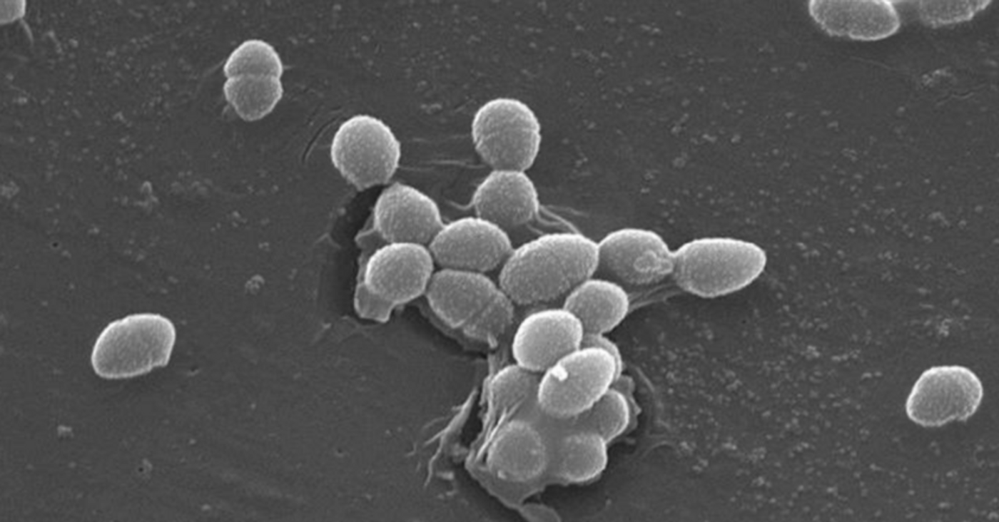 Scanning Electron Micrograph of Enterococcus faecalis, a common gut microbe / Credit: CDC / Pete Wardell