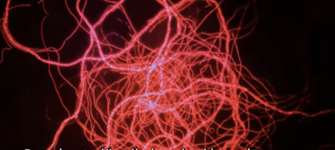 A screenshot from the video