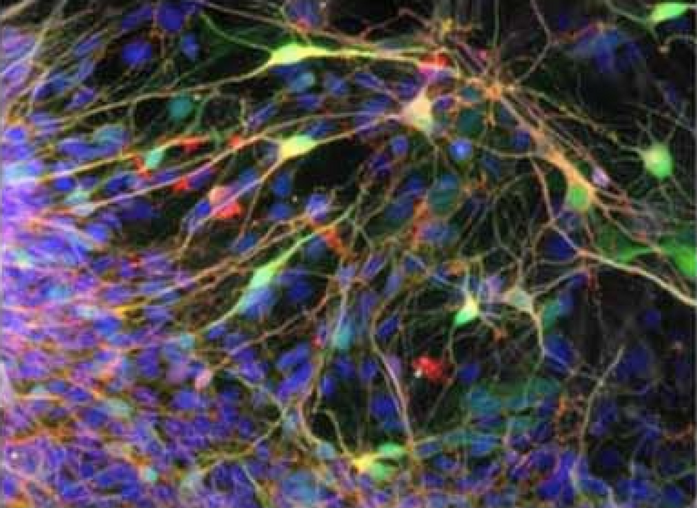 Human iPSC-derived neurons / Credit: eLife/Marchetto et al 2019
