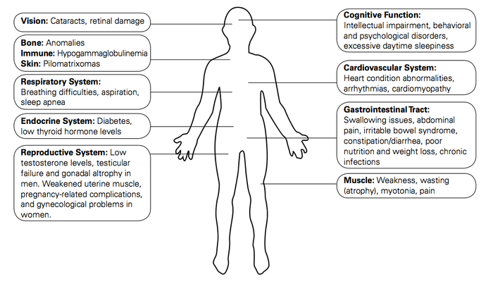 Symptoms of DM - via www.geneticdisorders.info
