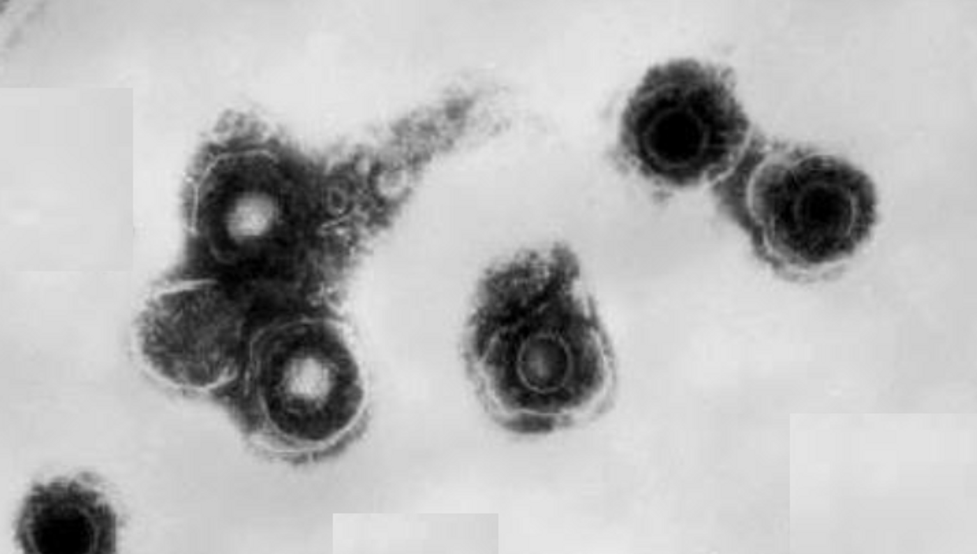 A TEM image from 1981 of several varicella zoster virus (VZV) virions / Credit: CDC / Dr. Erskine Palmer