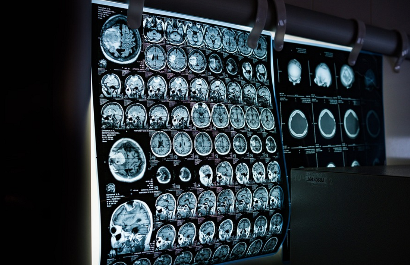 MRI scans / Image credit: Pixabay