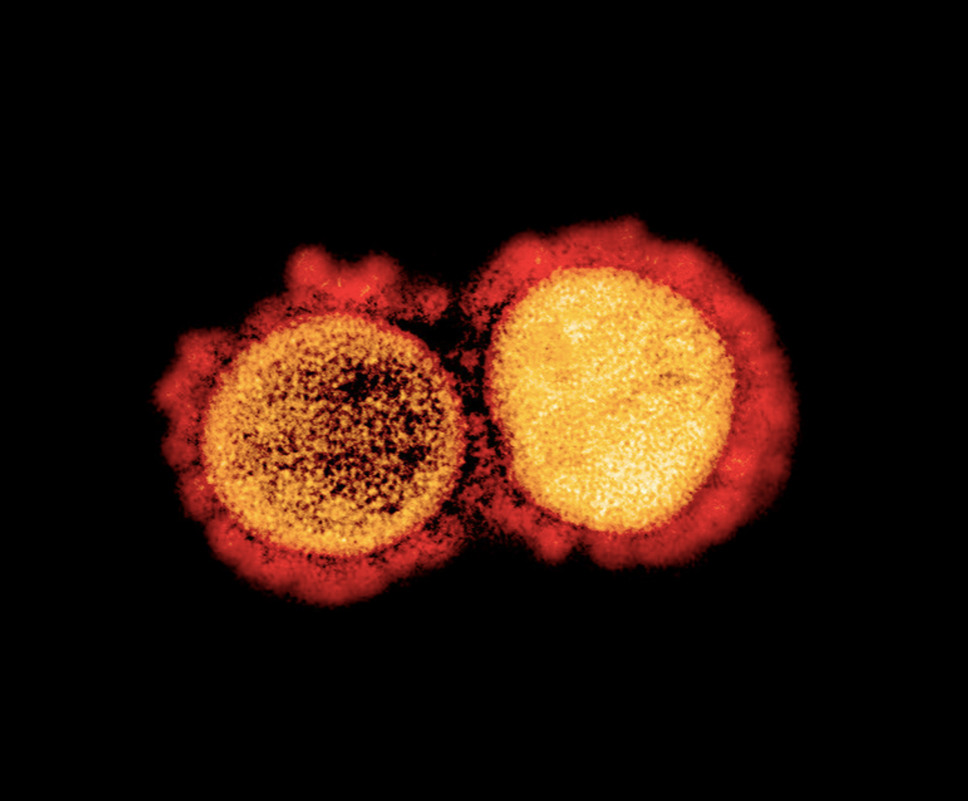 Transmission electron micrograph of SARS-CoV-2 virus particles, isolated from a patient. Image captured and color-enhanced at the NIAID Integrated Research Facility (IRF) in Fort Detrick, Maryland. / Credit: NIAID