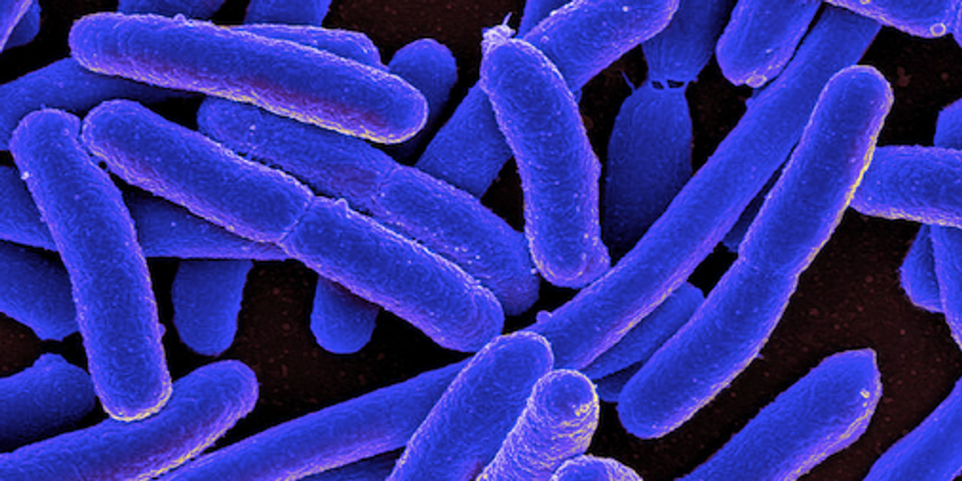 E. coli bacteria / Credit: NIAID
