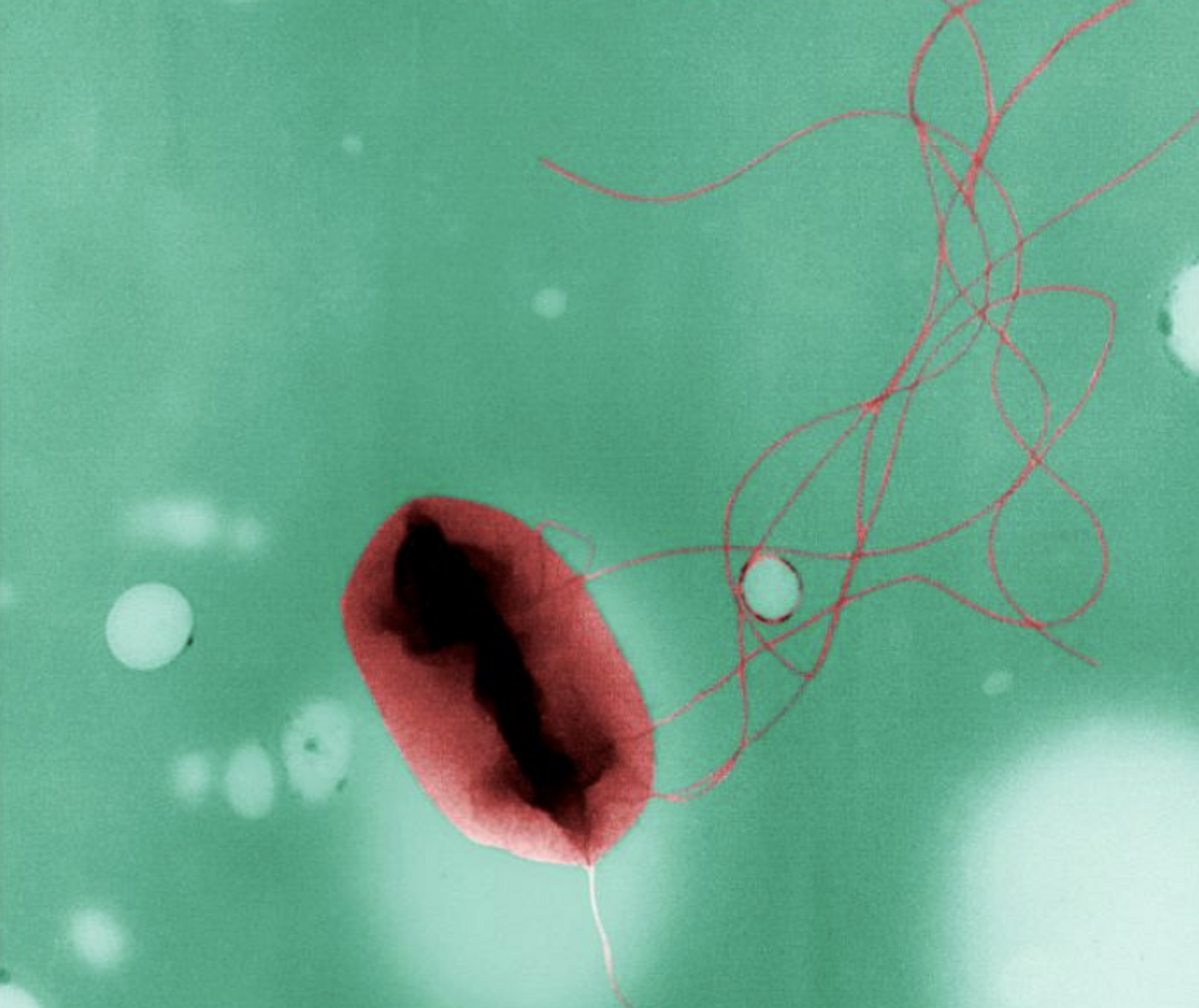 A digitally-colorized EM image of an Escherichia coli, strain O157:H7 bacterium. / Credit: CDC/ Peggy S. Hayes / Photo Credit: Elizabeth H. White, M.S.