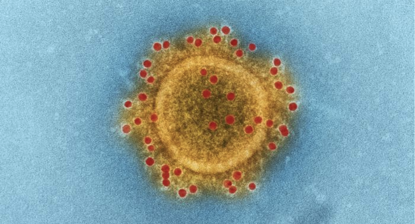  highly magnified, digitally colorized TEM image highlighting the particle envelope of a Middle East respiratory syndrome coronavirus (MERS-CoV) virion / Credit: National Institute of Allergy and Infectious Diseases